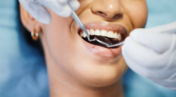 Best Emergency Wisdom Teeth Removal in Penn Valley, CA